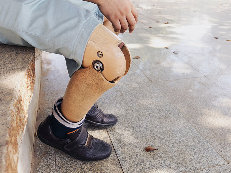 This smart prosthetic ankle is as close as it gets to the real thing